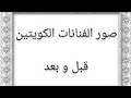الفنانات الكويتيات قبل و بعد  