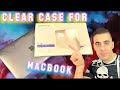 Unboxing ClearCase For MacBook Pro M1 13 Inch . 2022 For Only 25$