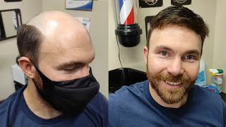 Thin Skin Hair System Review Salon Cut-In Style For The Lordhair Uts Ultra-Thin Skin Hair System