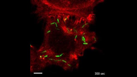 The Shigella flexneri actin tail in untreated conditions
