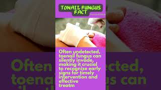 Natural Remedy: Toe Nail Fungus Cure #onychomycosis #howtocurenailfungus #fungalinfection