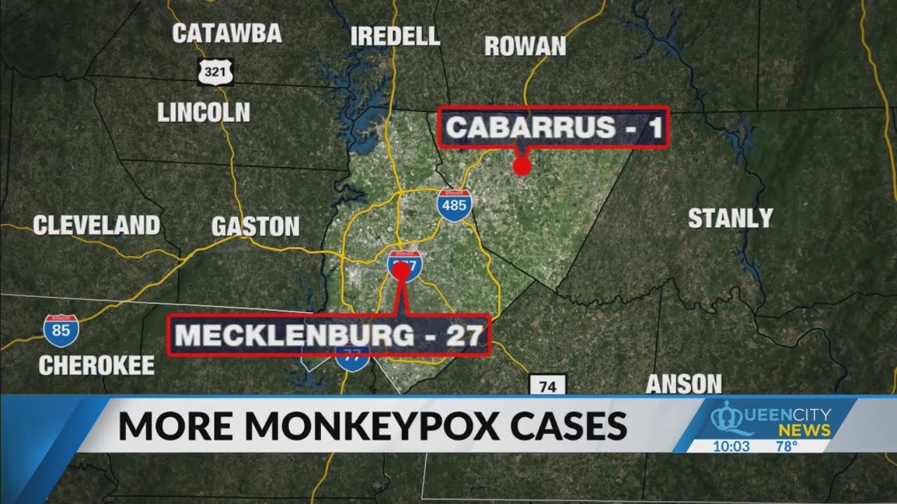 Mecklenburg County only 1 of 9 NC counties to get monkeypox vaccine