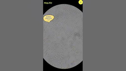 How sperm are produced under a microscope | TULO - Microscope #sperm #testicles #microscope #shorts