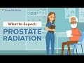 What to Expect Before Starting Radiation Treatment for Prostate Cancer