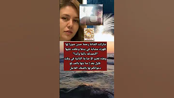 إ صا بة جديدة تتعـ ـر ض لها رحمة حسن بعد الصلـ ـع 