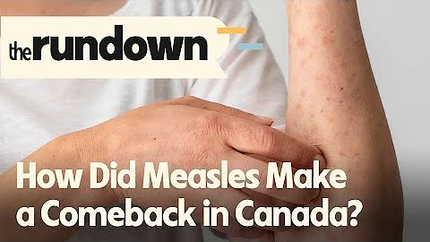 How Did Measles Make a Comeback in Canada? | The Rundown