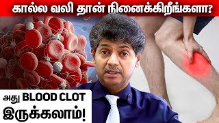 கால்ல வலி தான் நினைக்கிறீங்களா அது Blood Clot இருக்கலாம்! | DR Bala Kumar Update