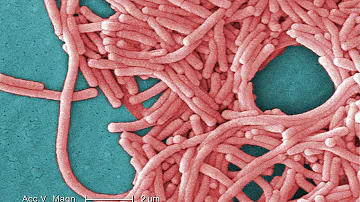 Come ci si contagia con la Legionella?