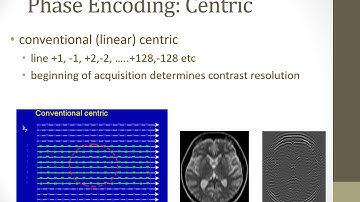 CE MRA K space Filling Methods
