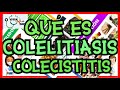 QUÉ ES COLELITIASIS Y COLECISTITIS | GuiaMed