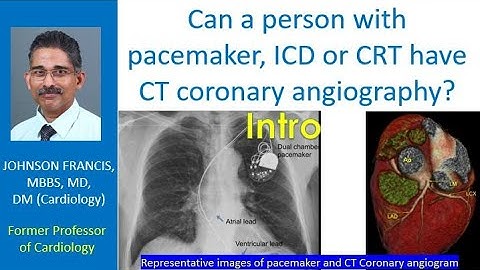 Can a person with pacemaker, ICD or CRT have CT coronary angiography? Intro