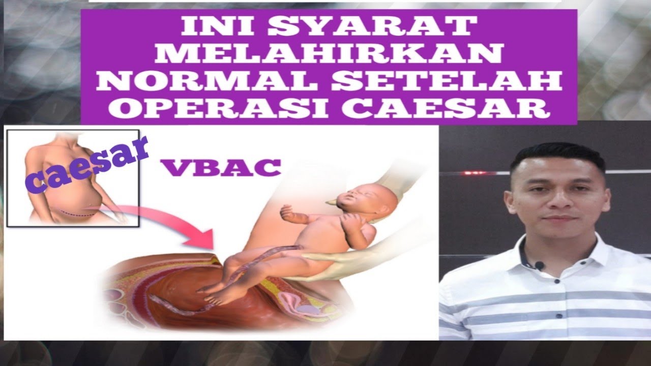 Ini syarat untuk mau lahir normal setelah operasi caesar... YouTube