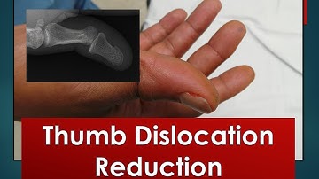 Thumb Dislocation Reduction