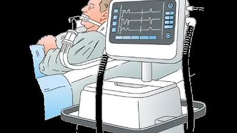 Basic & Advanced Modes of Ventilation ~ Overview