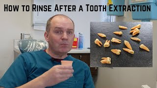 How to rinse gently after dental surgery. by Very Nice Smile Dental 61,750 views 1 year ago 3 minutes, 1 second