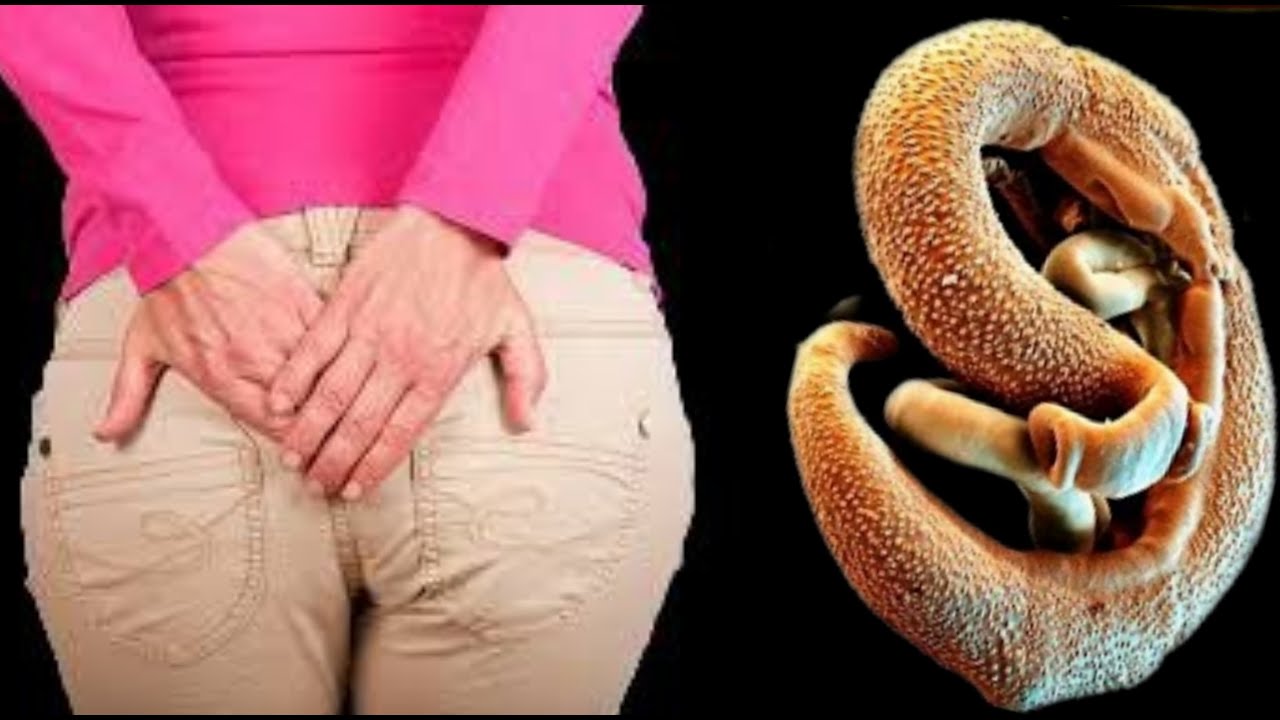 Was Tun Gegen Parasiten Im Körper www.youtube.com