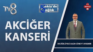 Akciğer Kanseri Nedir? Dr. Öğr. Üyesi Salih Cüneyt Aydemir 8De Sağlık