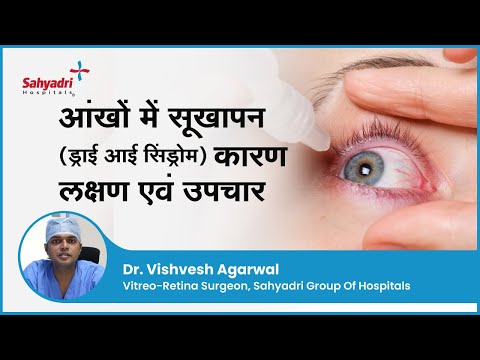 आंखों में सूखापन (ड्राई आई सिंड्रोम)- कारण लक्षण एवं उपचार | Dry Eye Syndrome | Dr Vishvesh Agarwal
