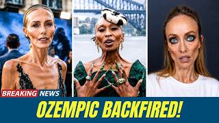 The Most Shocking Ozempic Face Transformations Before After 2026