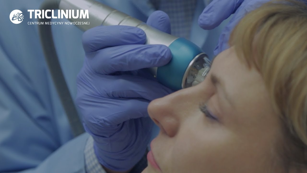 Unoszenie powieki górnej za pomocą radiofrekwencji mikroigłowej lub lasera frakcyjnego | L'Experta