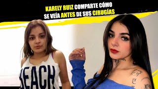 KARELY RUIZ shares PHOTO of herself before her SURGERIES