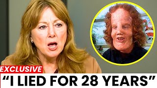 Before She Died, Rocky Dennis's Mom FINALLY Broke Silence About Rocky Dennis And It's Not Good