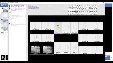 Training: Apteryx XVWeb: Acquiring an FMX 18 in XVCapture