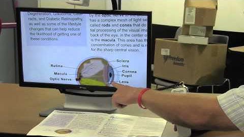 Onyx HD Video Magnifier