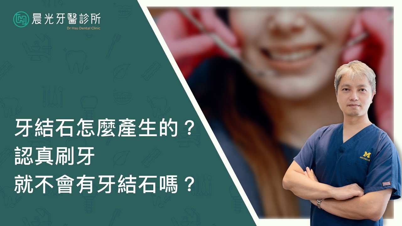 【晨光牙醫診所】為什麼會有牙結石？｜徐振祥醫師 縮圖