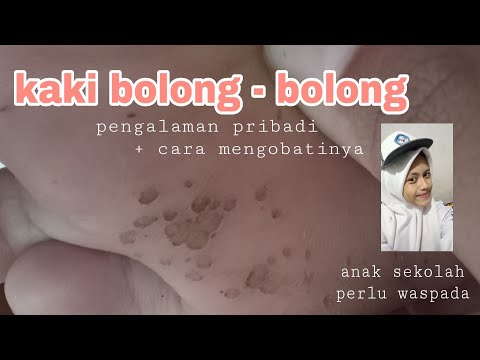 Salep 88 Untuk Kaki Rayapan