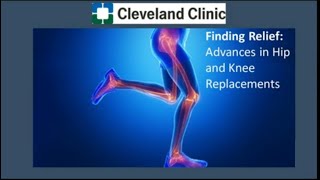 Finding Relief: Advancements in Hip and Knee Replacements