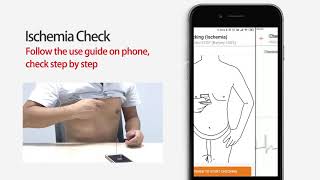 Borsam Biomeical  ECG Event Recorder: WeCardio UN, Electrocardiogram, ECG Monitor, Arrhythmia, EKG screenshot 4