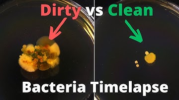 What Grows On Your Hands? Washed vs Unwashed in Bacteria Timelapse