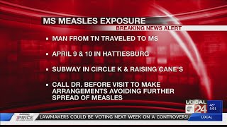 Tennessee man with the measles traveled to Mississippi when he was still contagious