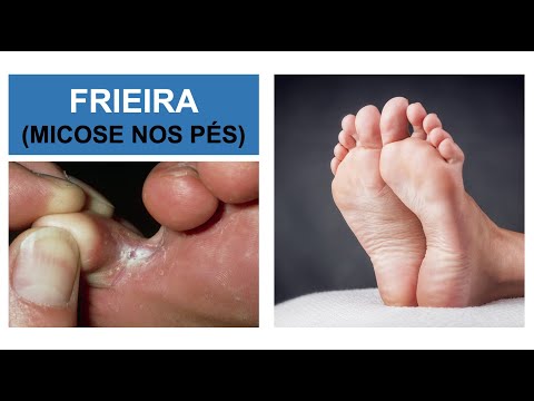 Vídeo: Como tratar pés frios: 14 etapas (com fotos)