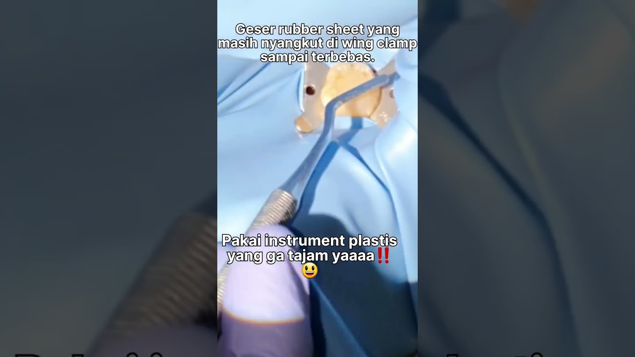 ‼️RUBBER DAM ISOLATION ONE STEP TECHNIQUE‼️