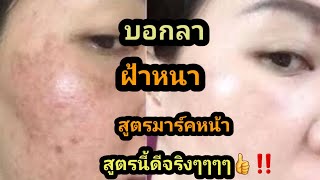 #สูตรรักษาฝ้า กระ จุดด่างดำรอยสิวรอยดำจางลงทันใจสูตรมาร์คหน้าสูตรนี้เอาอยู่