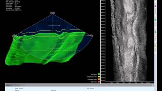 New Sonar interface