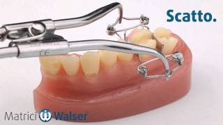 Anelli Morsetto Per Matrice Dentale - Clip In Titanio E PEEK Trasparente (Debole E Forte) - Foto 2