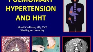 2016 02 24 19 00 HHT and PH  Connecting the Dots