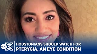 Why Houstonians should watch for Pterygia, an eye condition