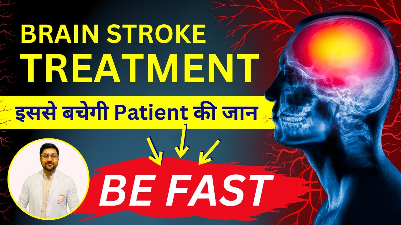 Brain Stroke Treatment & Surgery Ischemic & Hemorrhagic Stroke Ka Ilaj Interventional