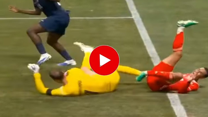 Jamal Musiala leg injury injury vs PSG vs Bayern Munich, Jamal Musiala injury vs PSG