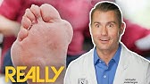Top 3 Most Perplexing Cases Ever Doctor Shocked My Feet Are Killing Me Youtube Top 3 Most Perplexing Cases Ever Doctor Shocked My Feet Are Killing Me Youtube