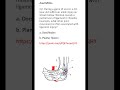 Medicine & Surgery MCQs (For MBBS, USMLE, MCCQE & PLAB)