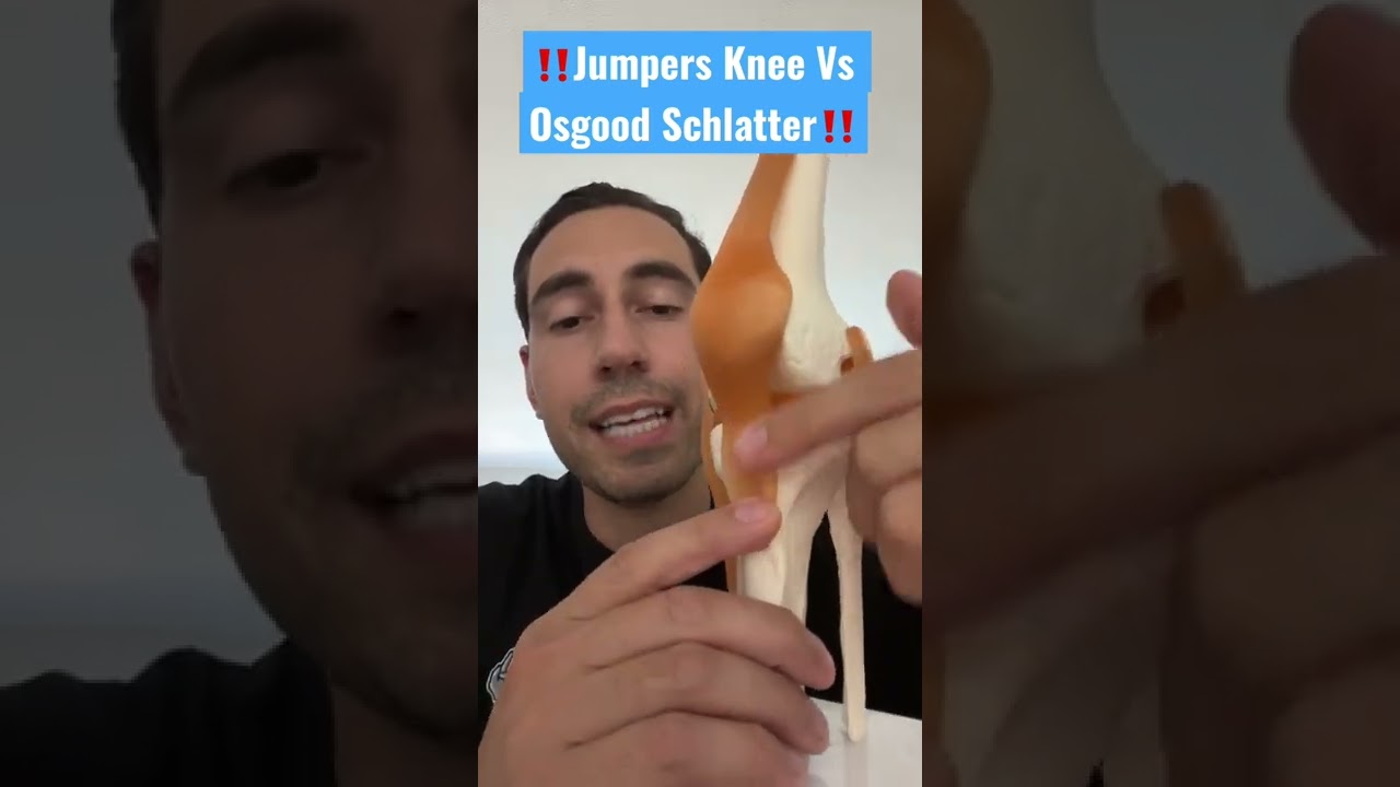 Jumpers Knee Vs Osgood Schlatter YouTube