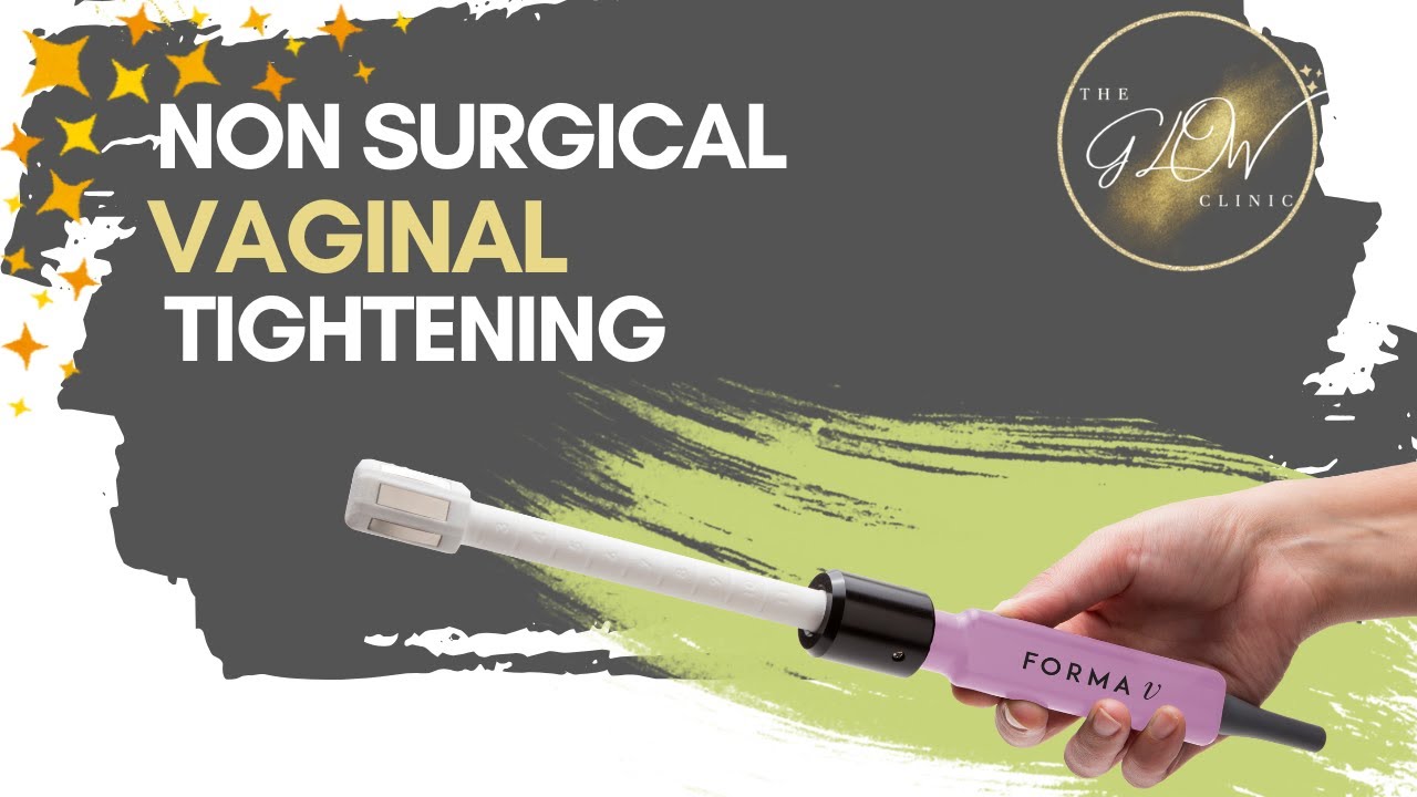 Formav Non surgical vaginal tightening | How FormaV Works and Why It’s a Game ...