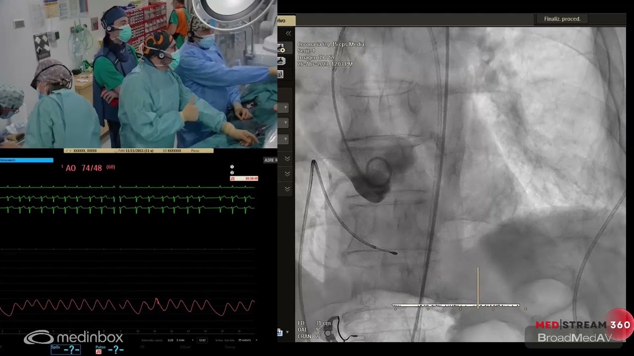 TAVR Using Allegra Self Expandable 27 mm Valve