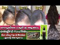 Extream hairgrowth in 2 weeks using  2ingredient hair oil  home reduce hairfalldandruff haircare