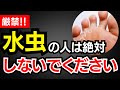 Absolutely Forbidden Three Things That People With Athlete S Foot Should Not Do Absolutely Forbidden Three Things That People With Athlete S Foot Should Not Do